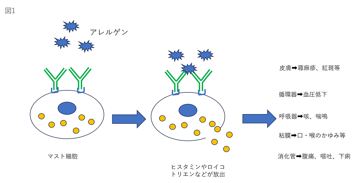 即時型とは